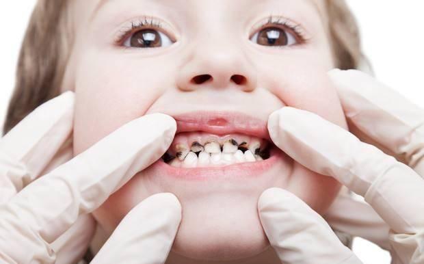 小孩没牙吃瓜,小牙童享甜蜜瓜果时光